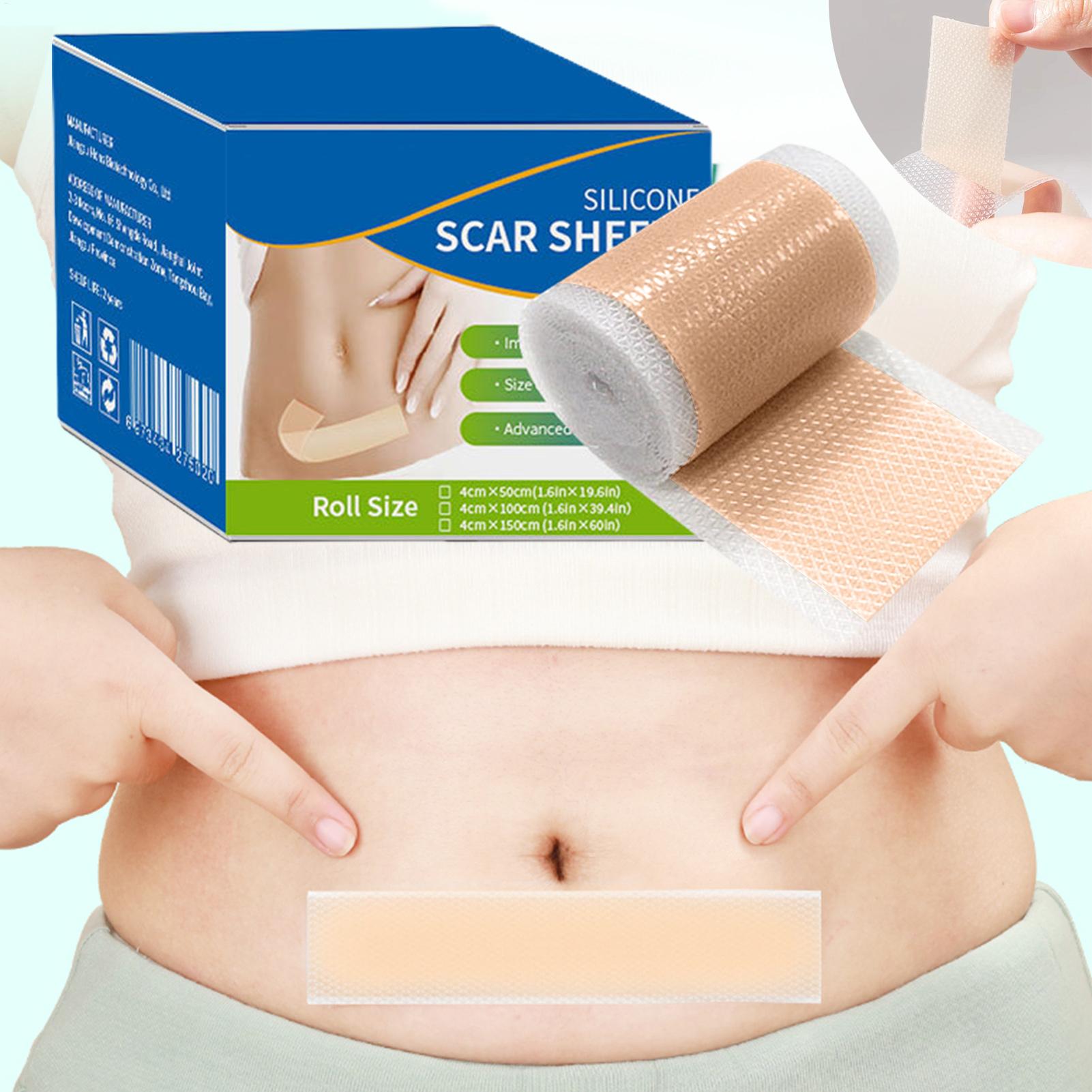 1 Roll Silicone Scar Sheets 4c – Sheet Mask Collagen Bewertung und Preis